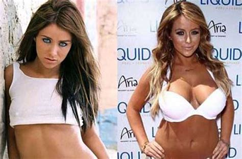 Aubrey O Day Plastic Surgery Before and After | | Plastic Surgery Magazine