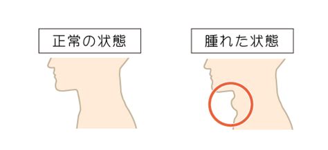 甲状腺について みなみ赤塚クリニック