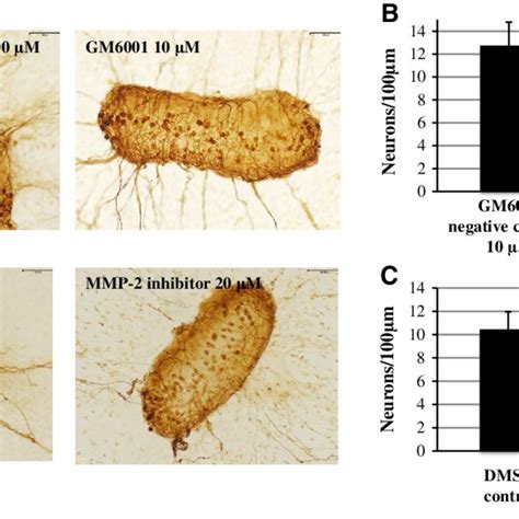 Effects Of Mmp Inhibition On Neuronal Survival From Sg Explants A Download Scientific Diagram