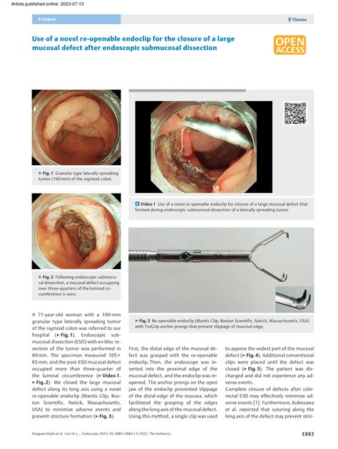 Pdf Use Of A Novel Re Openable Endoclip For The Closure Of A Large Mucosal Defect After