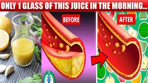 One Glass Of This Juice In The Morning Can Unclog And Reduce Plaque In