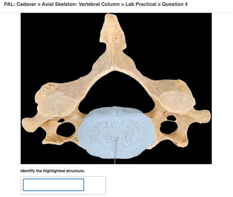 Solved PAL Cadaver Axial Skeleton Vertebral Column Lab Chegg