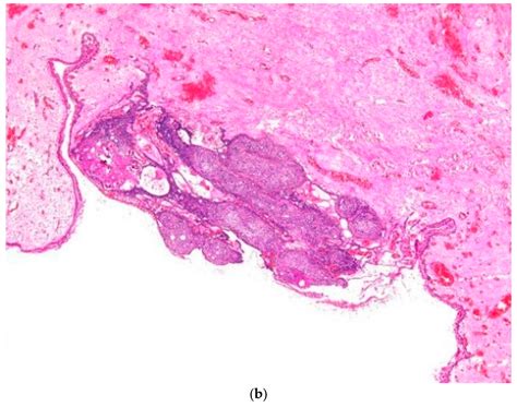 Diagnostics Free Full Text Clinico Pathological Presentations Of