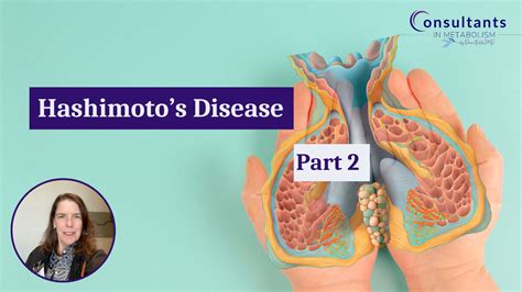 Hashimoto's Disease Part 2