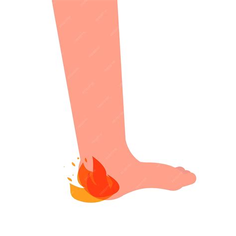 Premium Vector | Heel spur, aches, hot burn sensation. vector