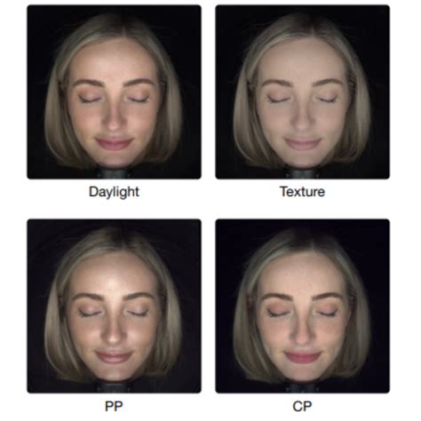 Observ Skin Analysis Tay Medispa