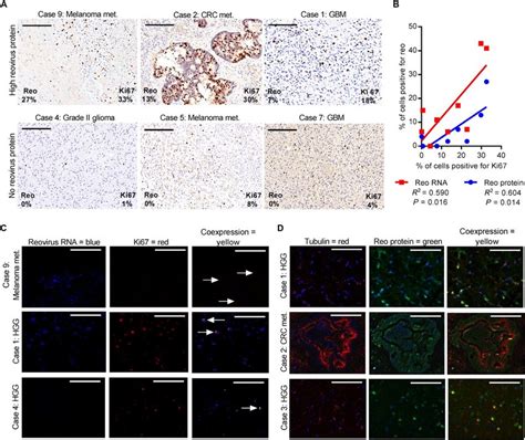 Correlation Of Reovirus RNA Protein With Proliferating Tumor Cells A