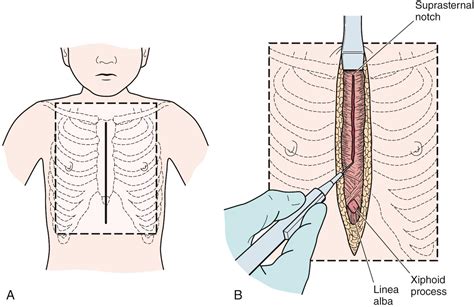 Surgical Techniques Clinical Tree