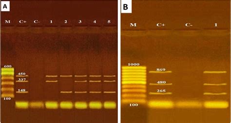 Agarose Gel Electrophoresis Of Multiplex PCR A Virulence Genes For