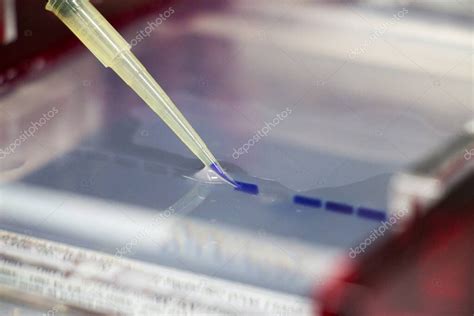 La Reacci N En Cadena De La Polimerasa Pcr Y La Electroforesis En Gel