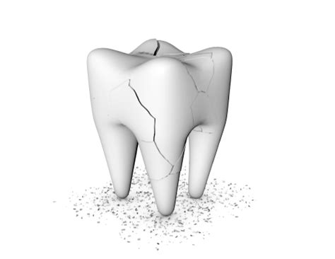 Cracked Teeth What Can Happen To Them And What Can Be Done To Fix Them