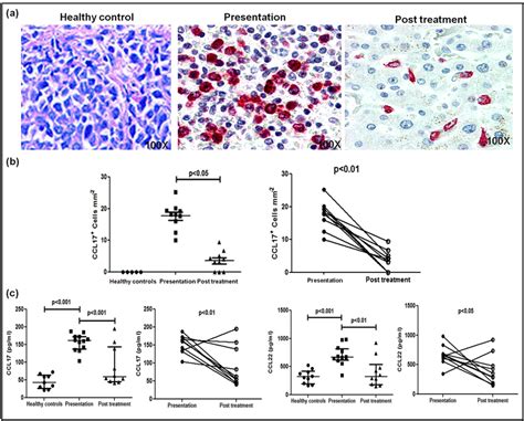 Dermal Homing Of Cd8 T Cells In Patients With Pkdl A Download Scientific Diagram