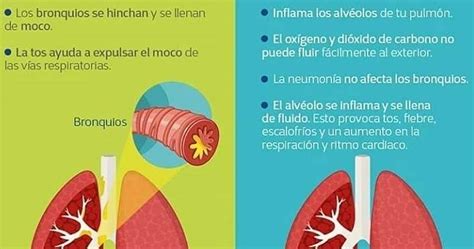 DIFERENCIA ENTRE BRONQUITIS Y NEUMONIA CONSULTAS MEDICAS ONLINE