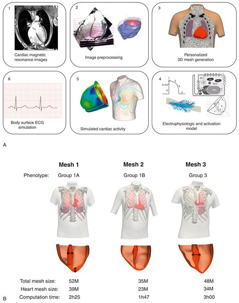 Distinct ECG Phenotypes Identified In Hypertrophic Cardiomyopathy Using