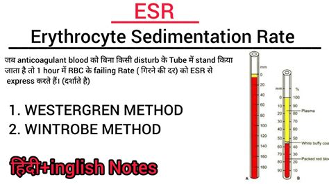 Esr Test In Hindi Notes Erythrocyte Sedimentation Rate Youtube