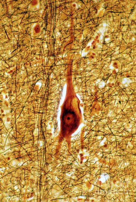 Lipofuscin In Pyramidal Neuron Photograph By Jose Calvo Science Photo