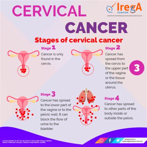 Cervical Cancer