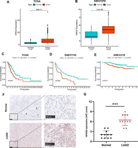 Npas Is Overexpressed And Associated With Poor Prognosis In Luad Ab