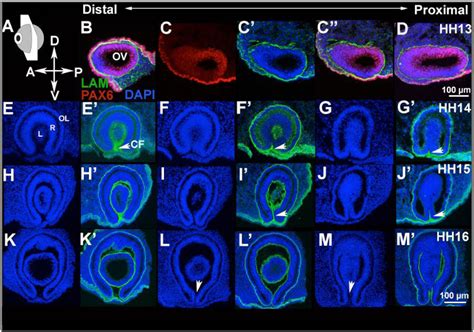 Figure 1 from The cellular bases of choroid fissure formation and closure. | Semantic Scholar