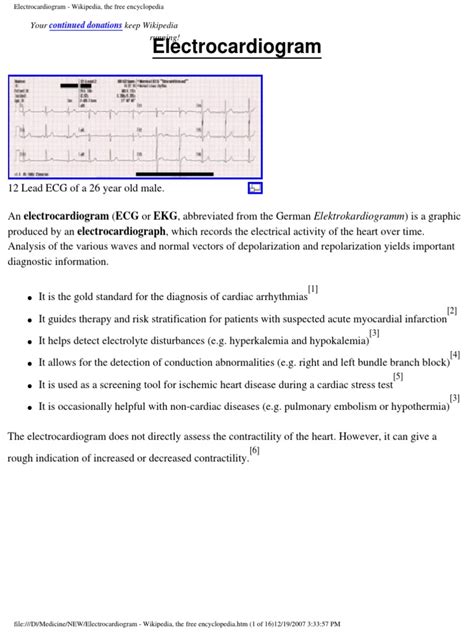 Electrocardiogram Wikipedia The Free Encyclopedia Pdf