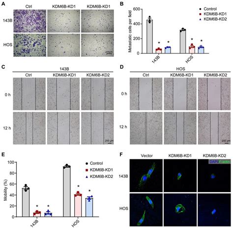 Kdm6b Promotes Osteosarcoma Cell Migration In Vitro A In Vitro