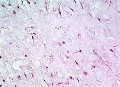 Mucous Connective Tissue Histology