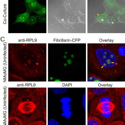 Localization Of Mmtv Gag And L In Mouse Mammary Cells A