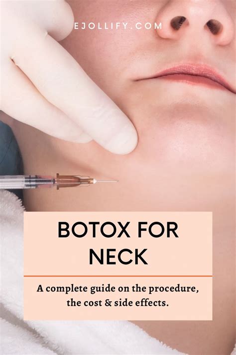 Best Areas For Botox Artofit