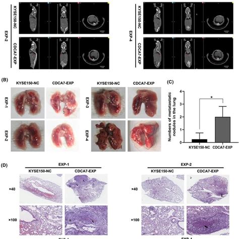 Cdca Promotes The Migratory And Invasive Capacities Of Escc Cells In