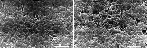 Scanning electron micrographs (×5000 magnification) showing wear of ... 