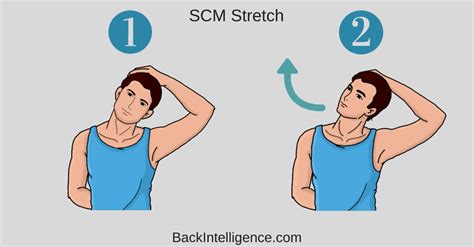 Sternocleidomastoid Stretch