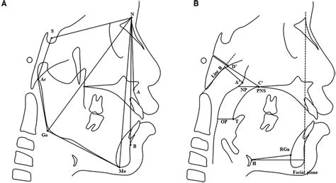 Frontiers Craniofacial And Upper Airway Morphological Characteristics