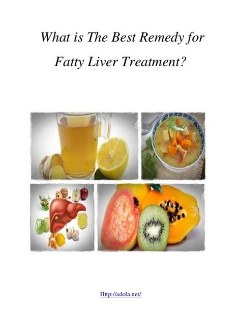 What is the best remedy for fatty liver treatment?