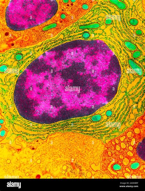 Plasma Cell Colour Transmission Electron Micrograph Of The Contents Of