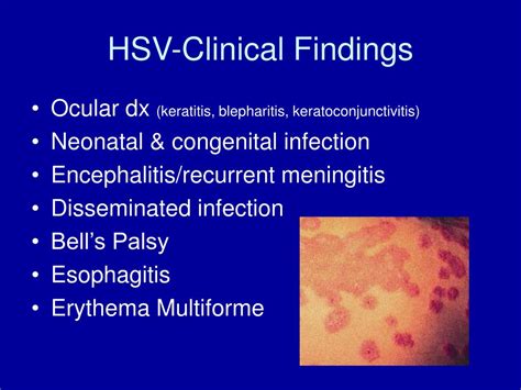 Ppt Viral Diseases Powerpoint Presentation Free Download Id255548