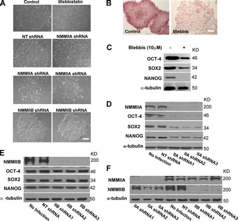 Nmmiia But Not Nmmiib Is Necessary For Multifaceted Hesc Functions A