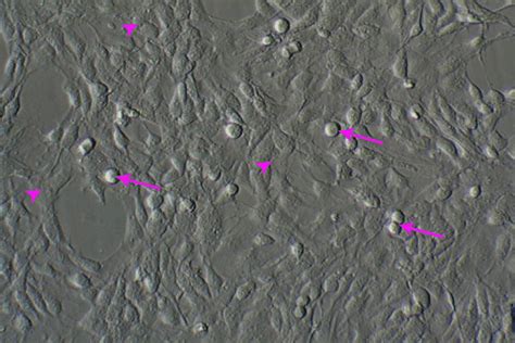 Neuroblast Assay Culture From E Mouse Neural Stem Cells On Day Of