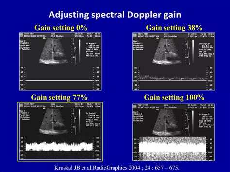 Principles Of Doppler Ultrasound Ppt