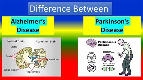 Difference Between Alzheimer S Disease And Parkinson S Disease Youtube