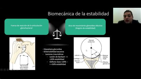 Generalidades En Inestabilidad De Hombro YouTube