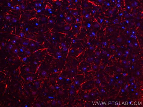 NF-H/NF200 antibody (18934-1-PBS) | Proteintech