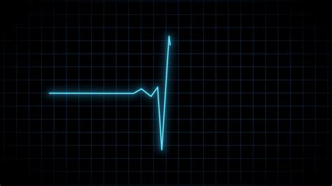 Animation Of Endless Loop Ekg Heart Stock Motion Graphics SBV-348647335 ...