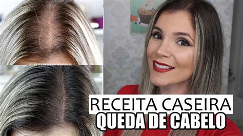 Receitas Caseiras Para Combater A Queda De Cabelo Dicas Do Dia A Dia