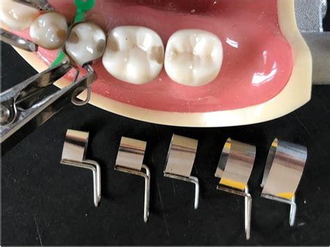 Matrix System Offers Five Sizes Dentistry Today