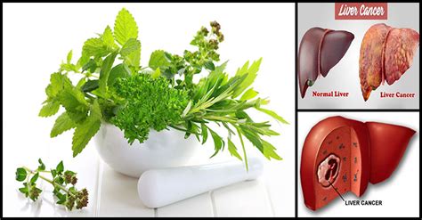 The Power Of Herbal Medicine For Treating Liver Cancer Dr Farrah Md