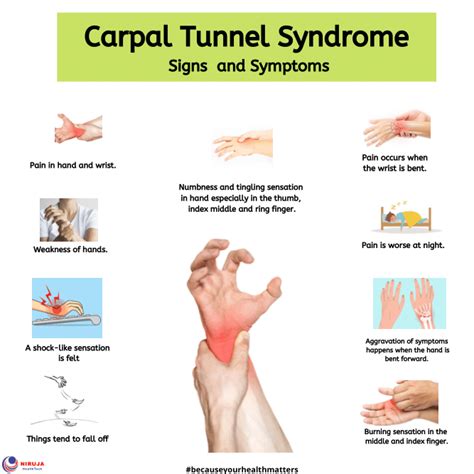 carpal tunnel syndrome causes - Charles Kane