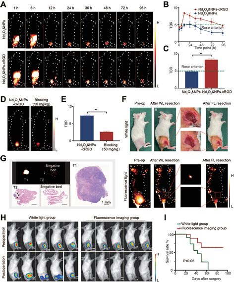 Intraoperative Surgical Margin Assessment By Nirii Imaging With Urine