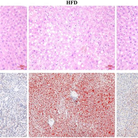 The Effects Of L Plantarum S On Pathological Changes In Liver Of Ms