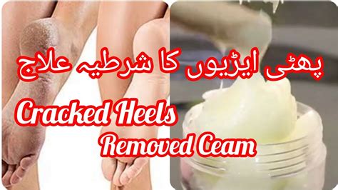 Remove Cracked Heels Remedy Phati Ariyan In Urdu Phati Ariyan