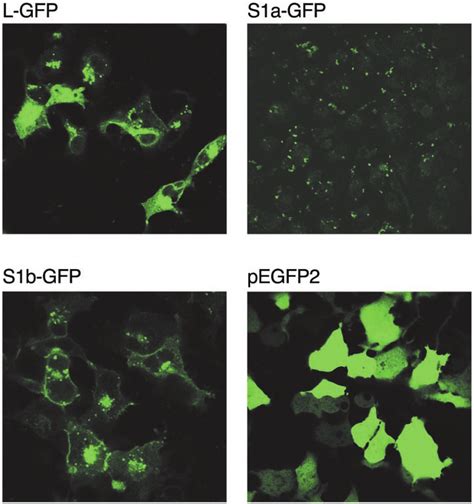 Confocal Microscopy Of Hprlr Gfp Fusion Receptor Proteins Transiently